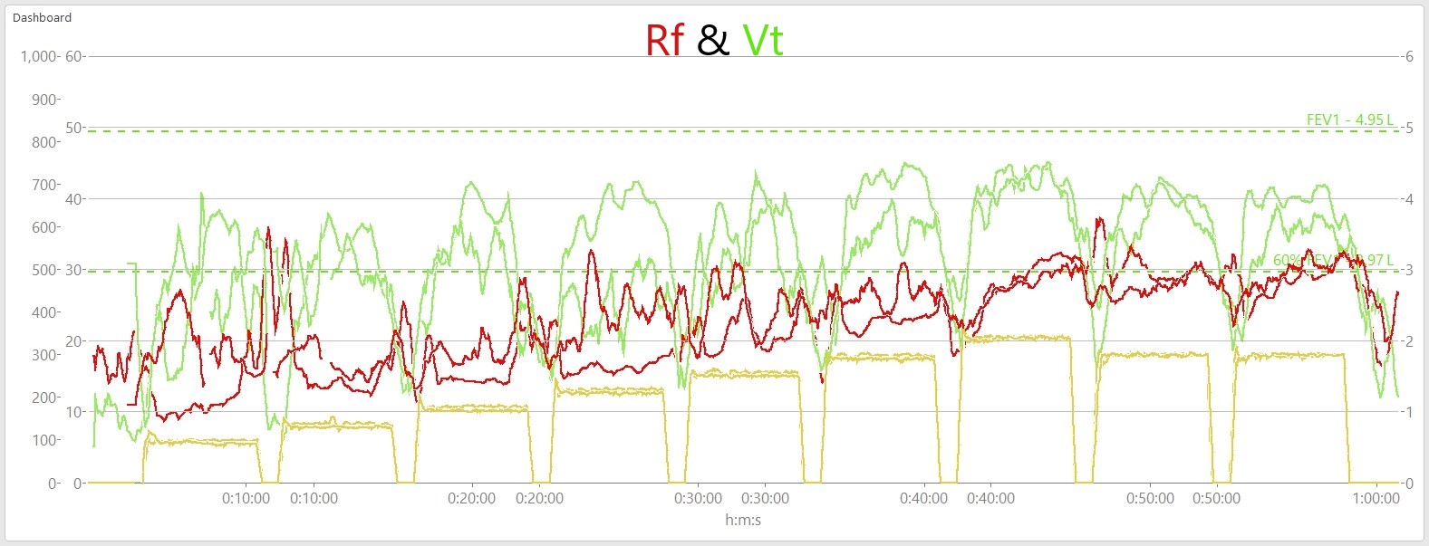 5-1_Vt_Rf_Comparison